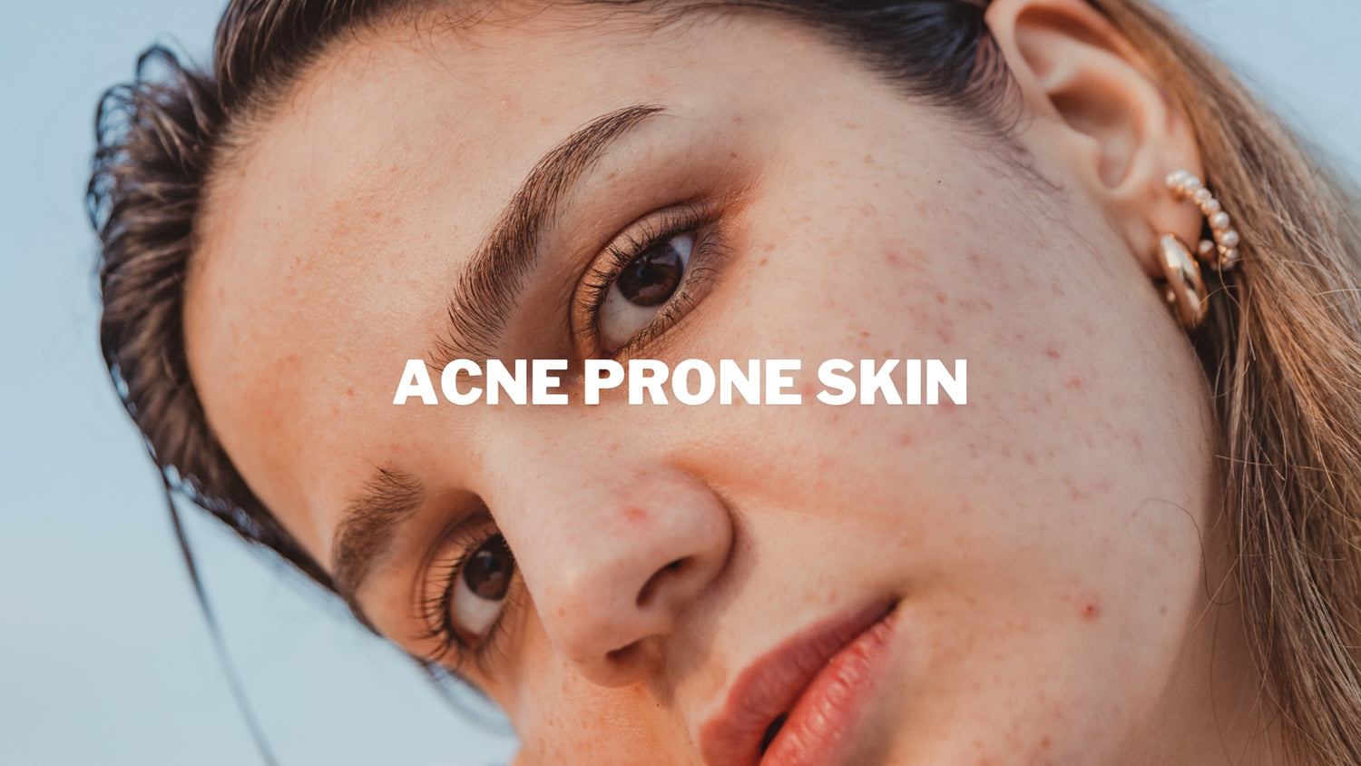 acne face skincare for women from Bree probiotics