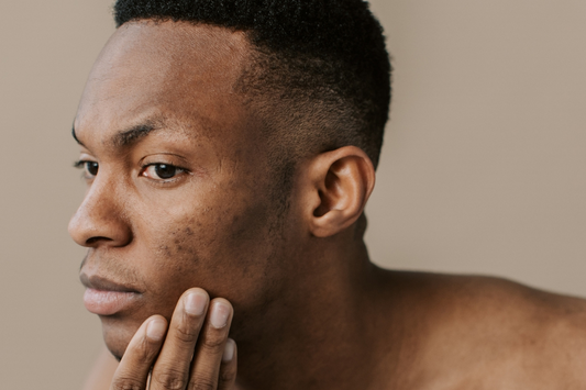 The Benefits of Probiotic Skincare for Skin Conditions